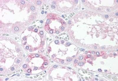 Immunohistochemistry-Paraffin: TM9SF4 Antibody [NBP3-14499] - Immunohistochemistry of formalin-fixed, paraffin-embedded human kidney after heat-induced antigen retrieval.